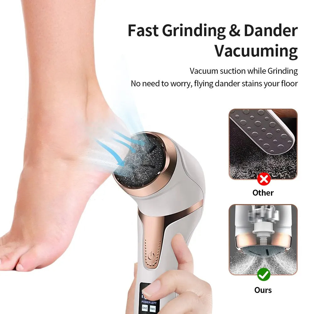 Electric foot callus remover-